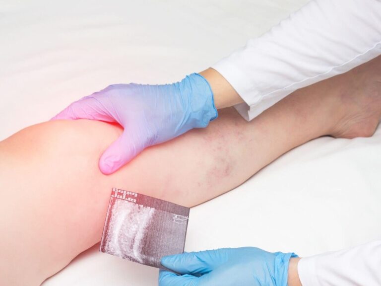 Rehabilitacja i ortopedia w Holispace