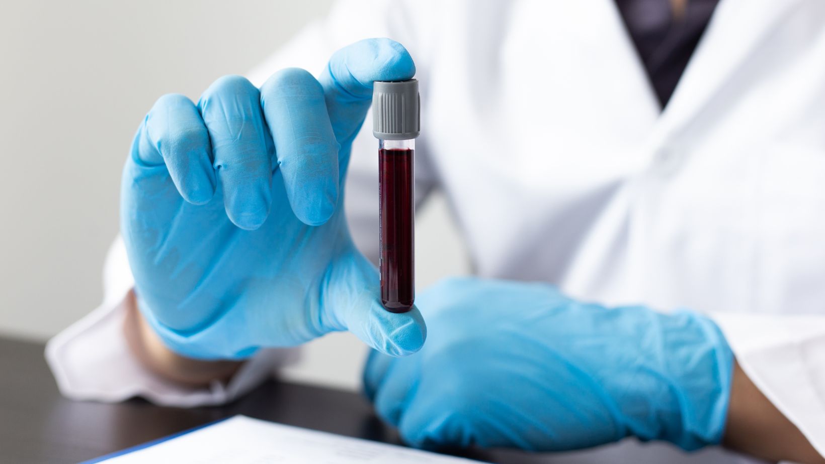 Osocze bogatopłytkowe w ortopedii