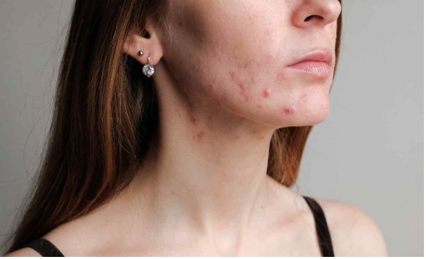 Podstawa pielęgnacji – oczyszczanie skóry