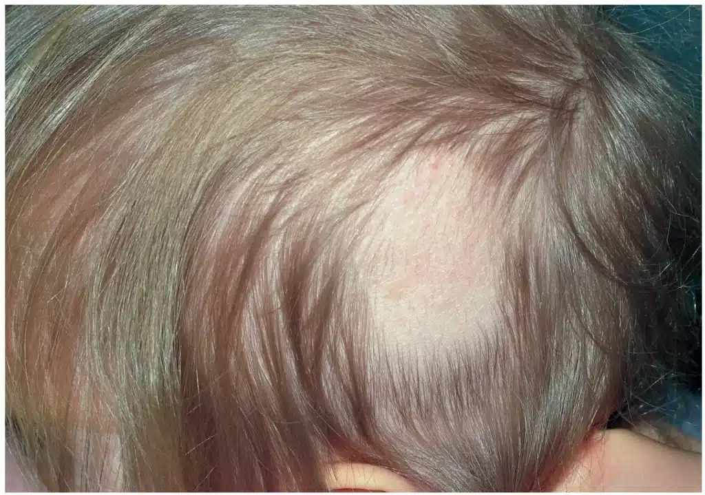 Co na wypadające włosy i skórę z problemami